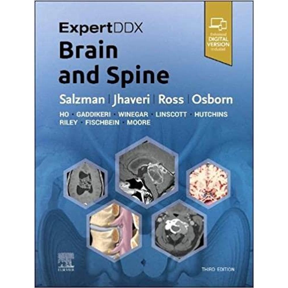 ExpertDDx: Brain and Spine