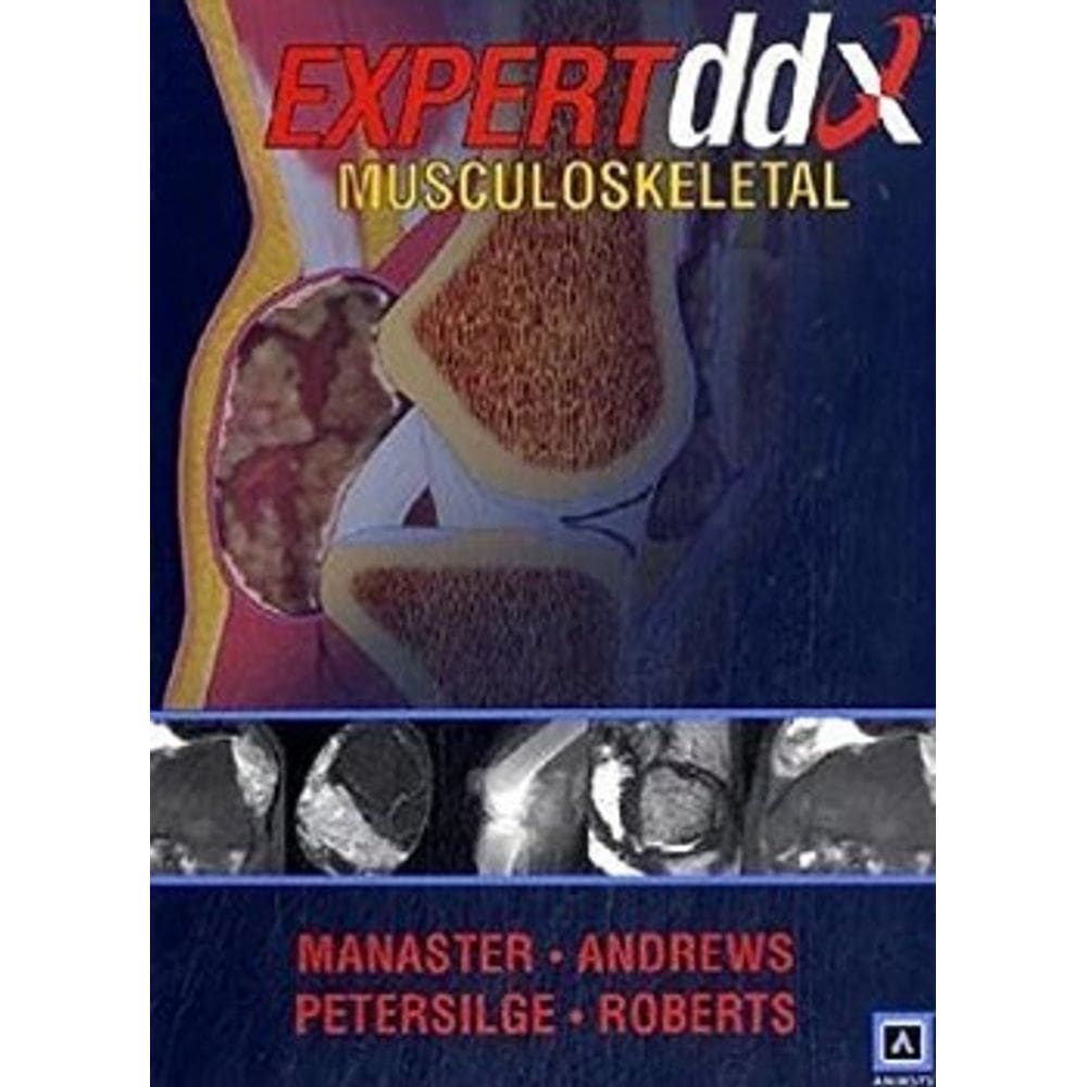 Expert Ddx: Musculoskeletal