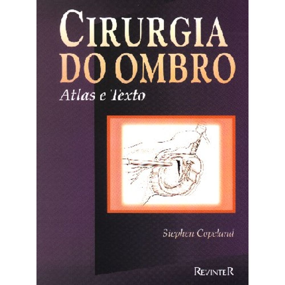 Cirurgia Do Ombro Atlas E Texto