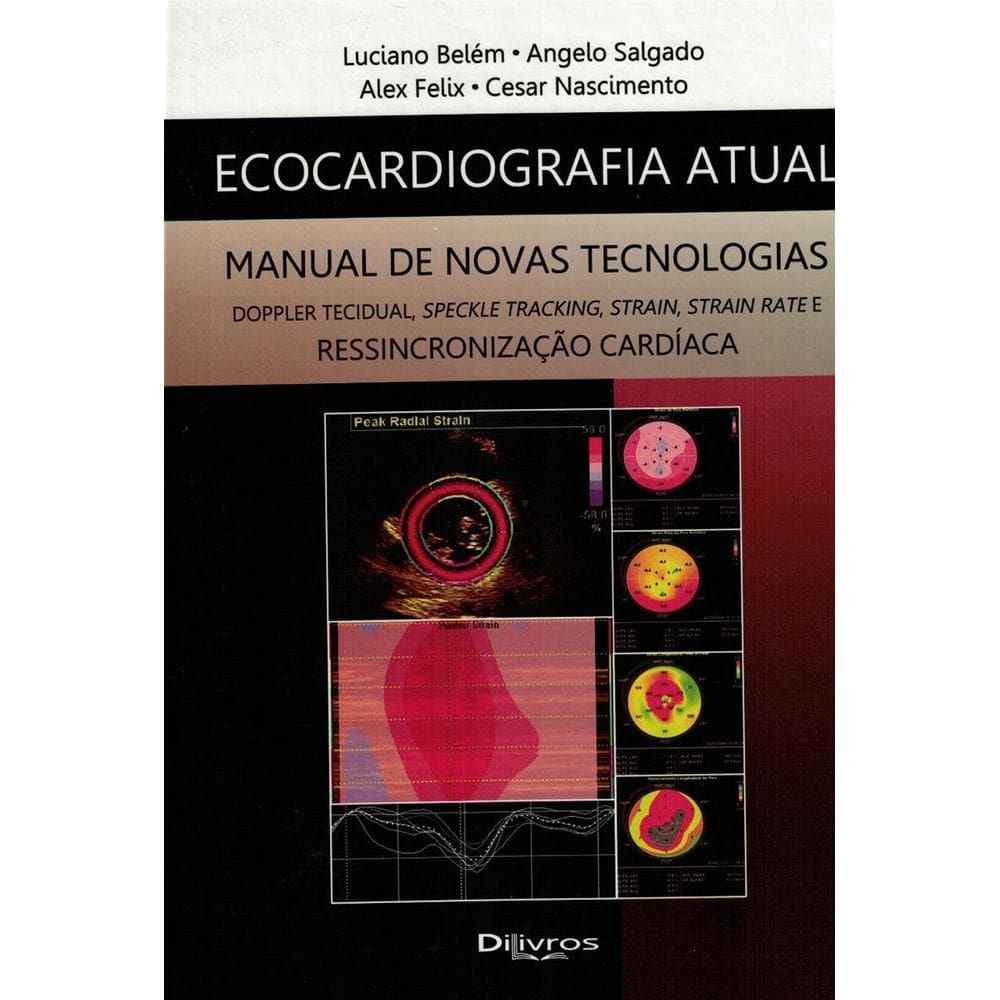 Ecocardiografia Atual Manual De Novas Tecnologias