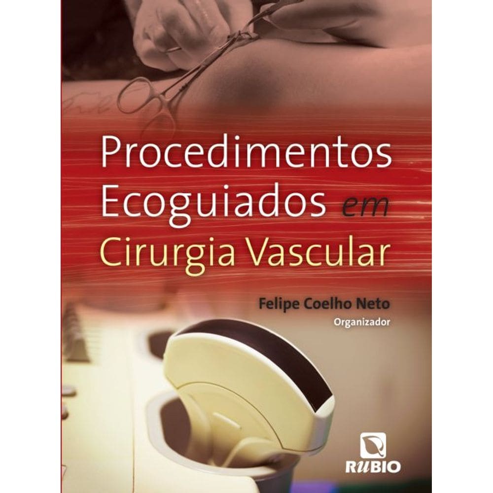 Procedimentos Ecoguiados Em Cirurgia Vascular