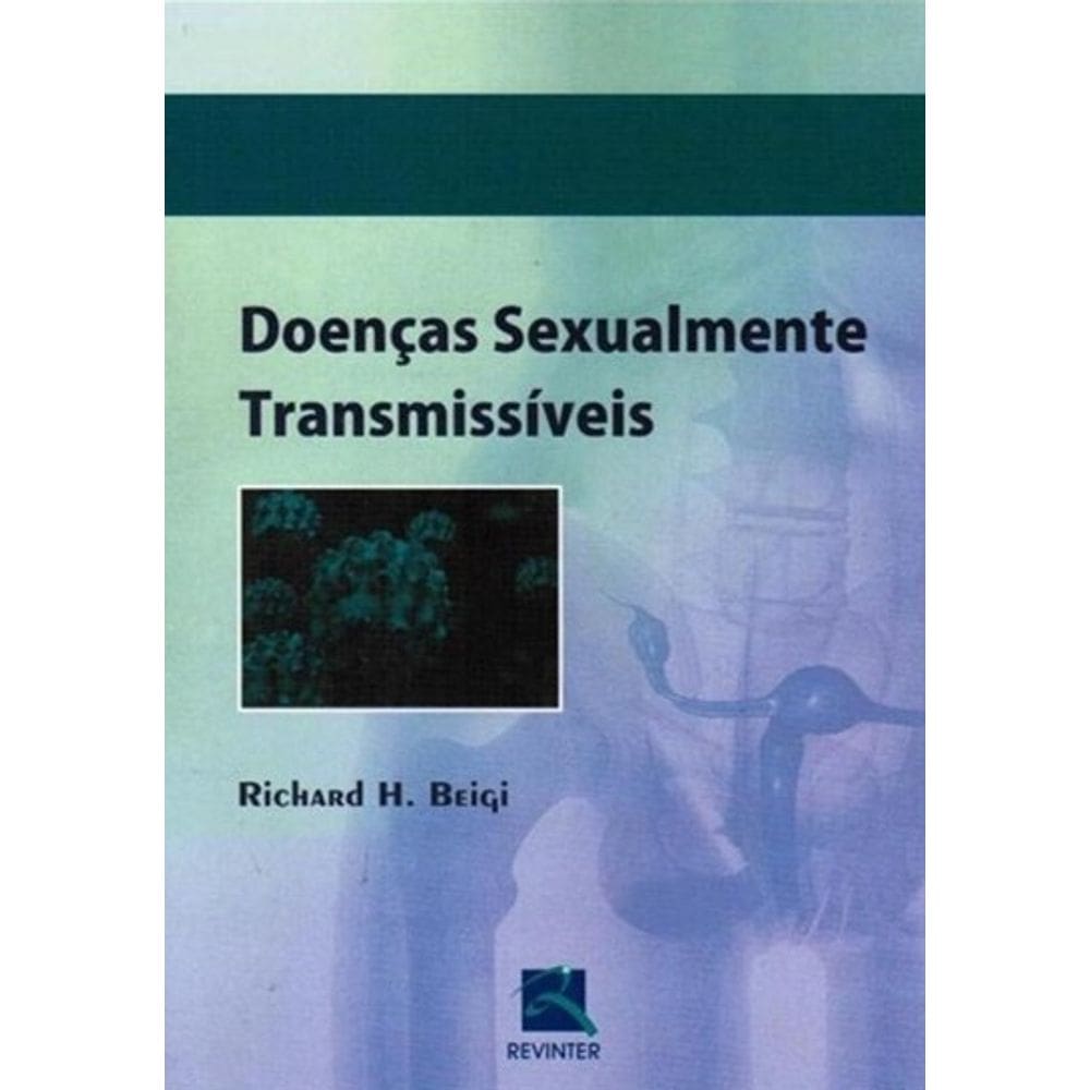 Doencas Sexualmente Transmissiveis