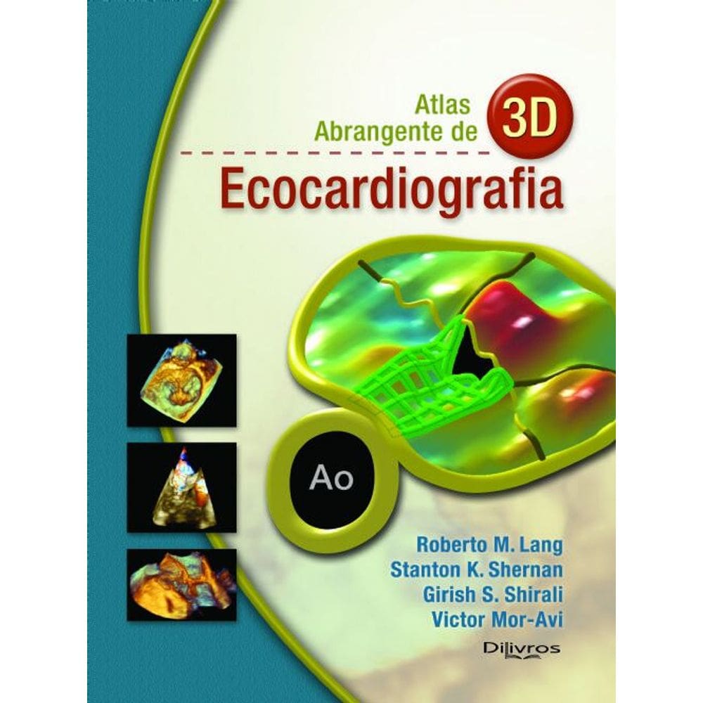 Atlas Abrangente De 3D Ecocardiografia