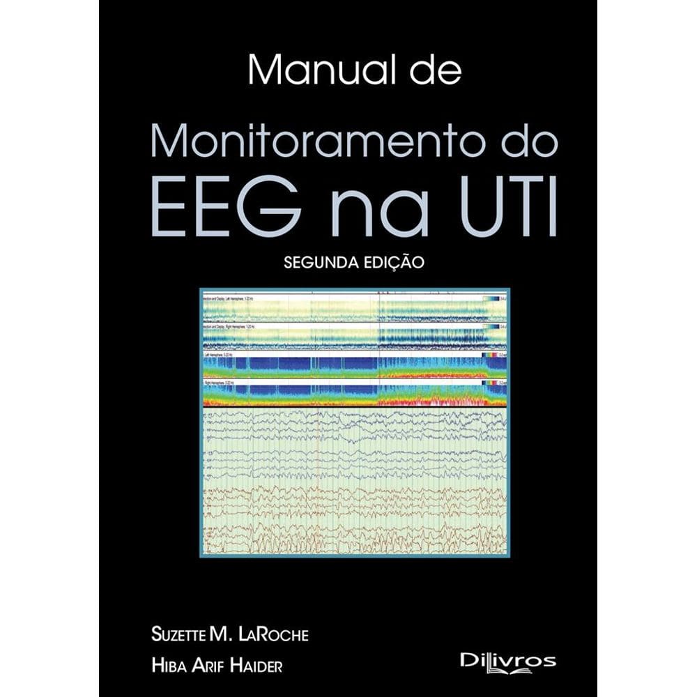 Manual De Monitoramento Do Eeg Na Uti
