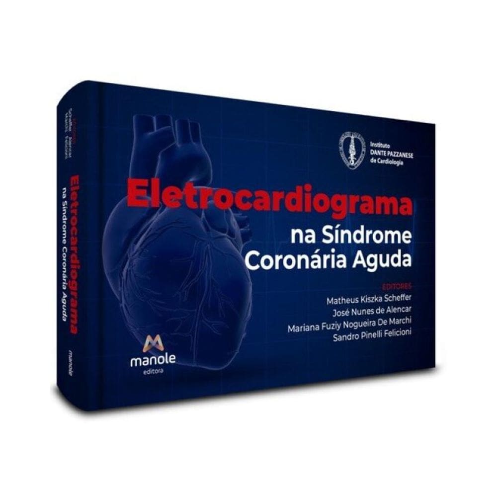 Eletrocardiograma Na Síndrome Coronária Aguda