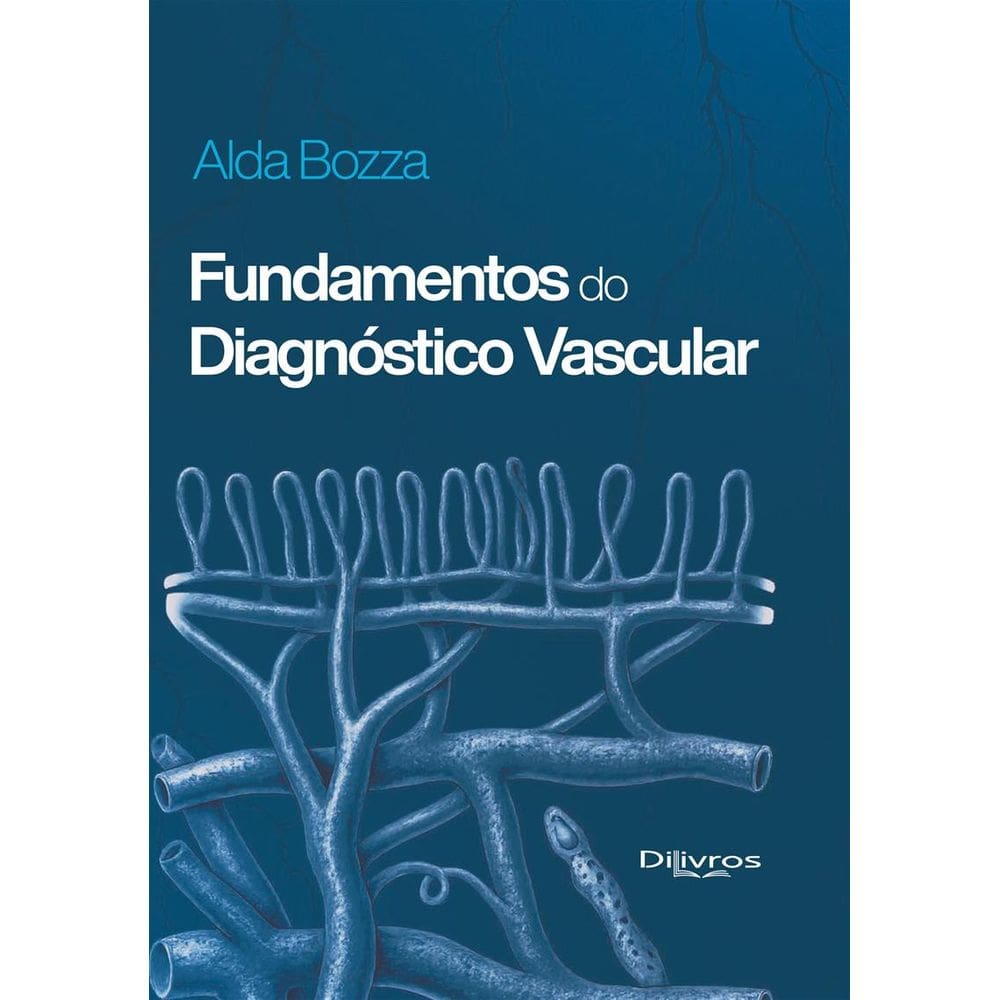 Fundamentos Do Diagnostico Vascular