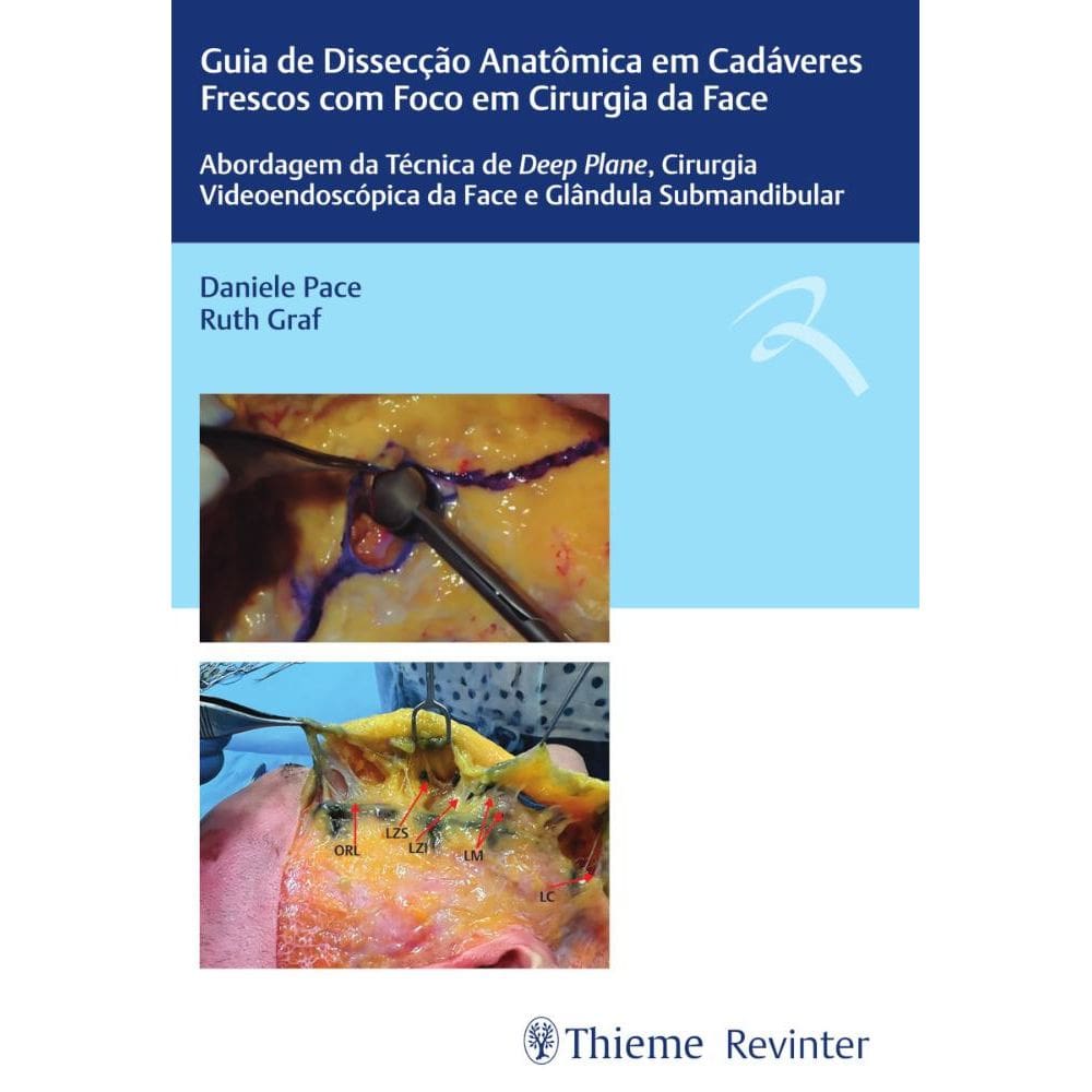 Guia Dissecção Anatômica Em Cadáveres Frescos C/Foco Em Cirurgia Da Face