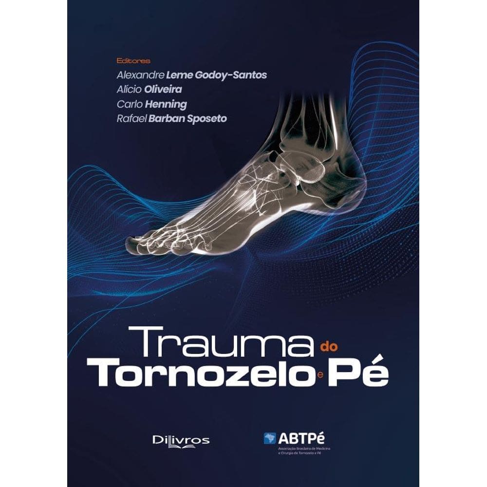 Trauma Do Tornozelo E Pe