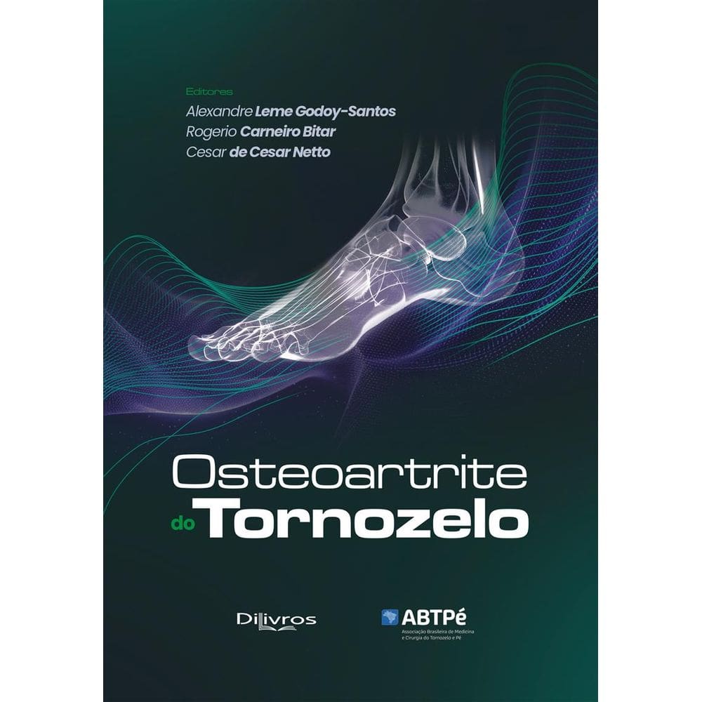Osteoartrite Do Tornozelo