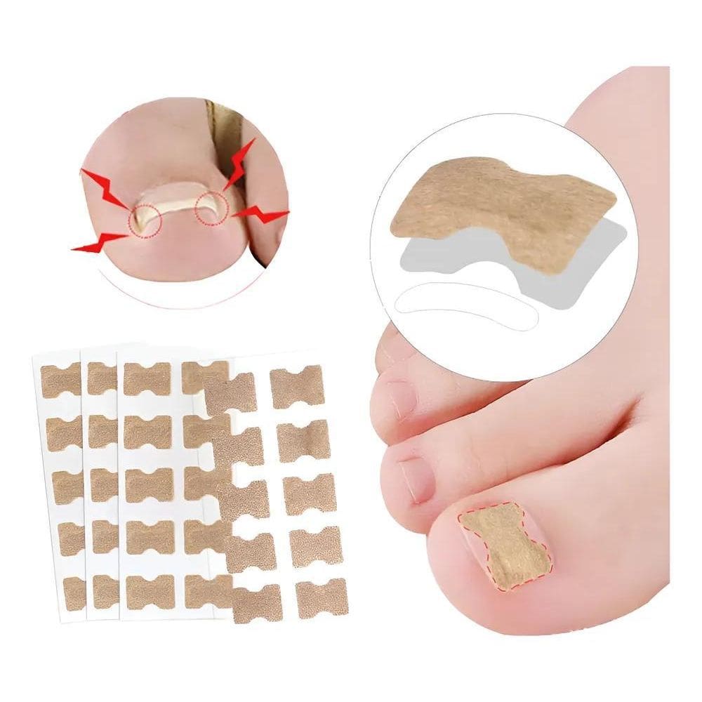 2X 40 Unidades Adesivo Corretor De Unha Encravada