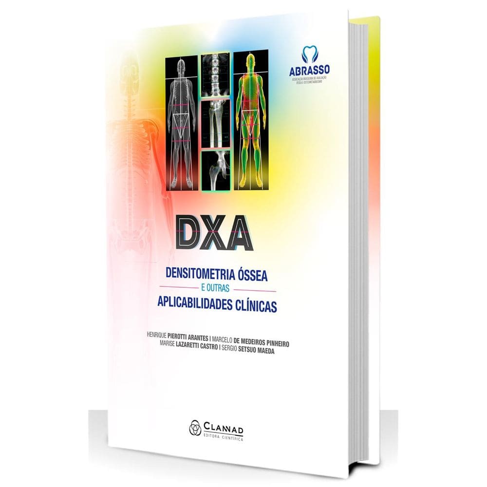 Dxa Densitometria Ossea E Outras Aplicabilidades Clinicas