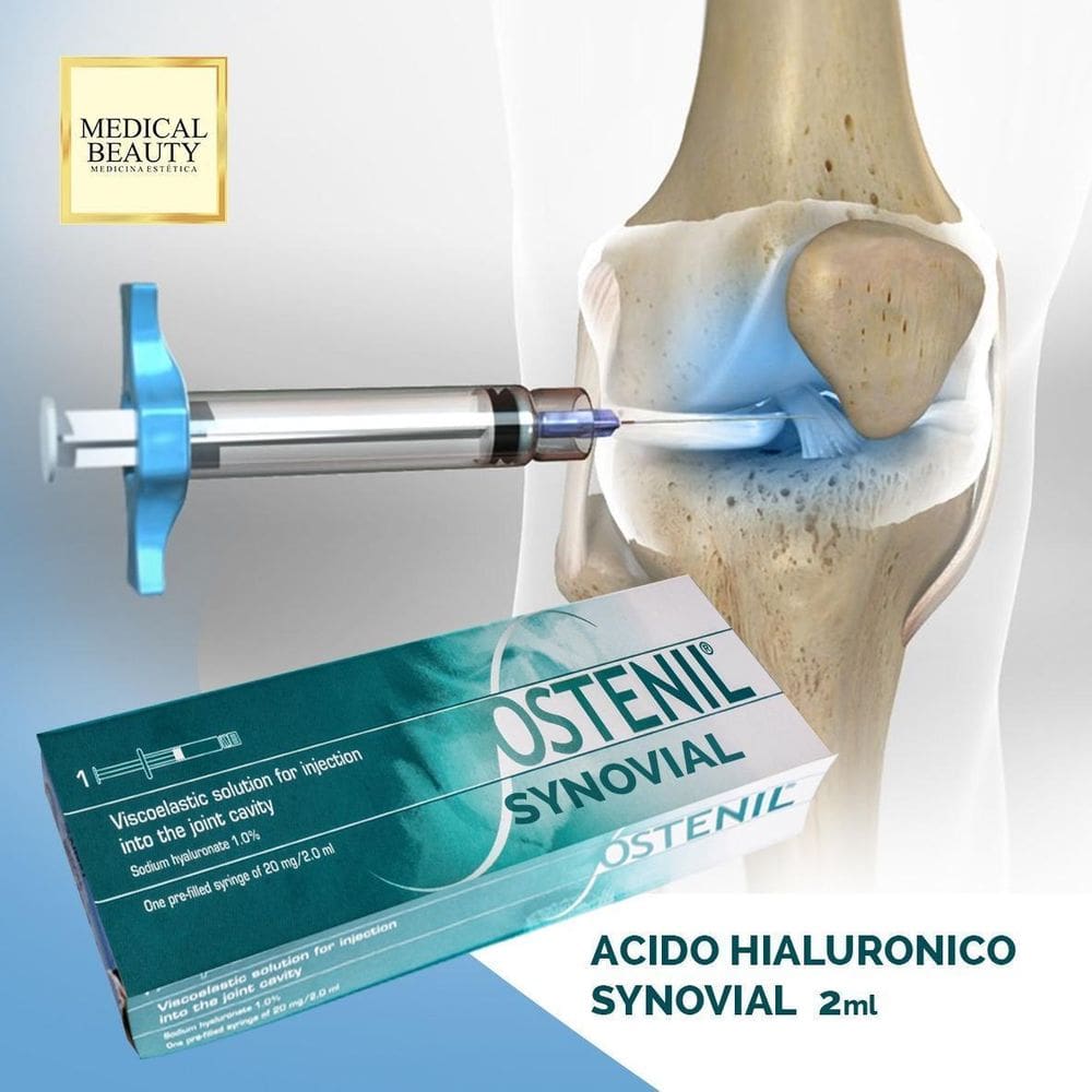 Suplemento Articular Synovial Ostenil 2Ml Cross Link -Anvisa