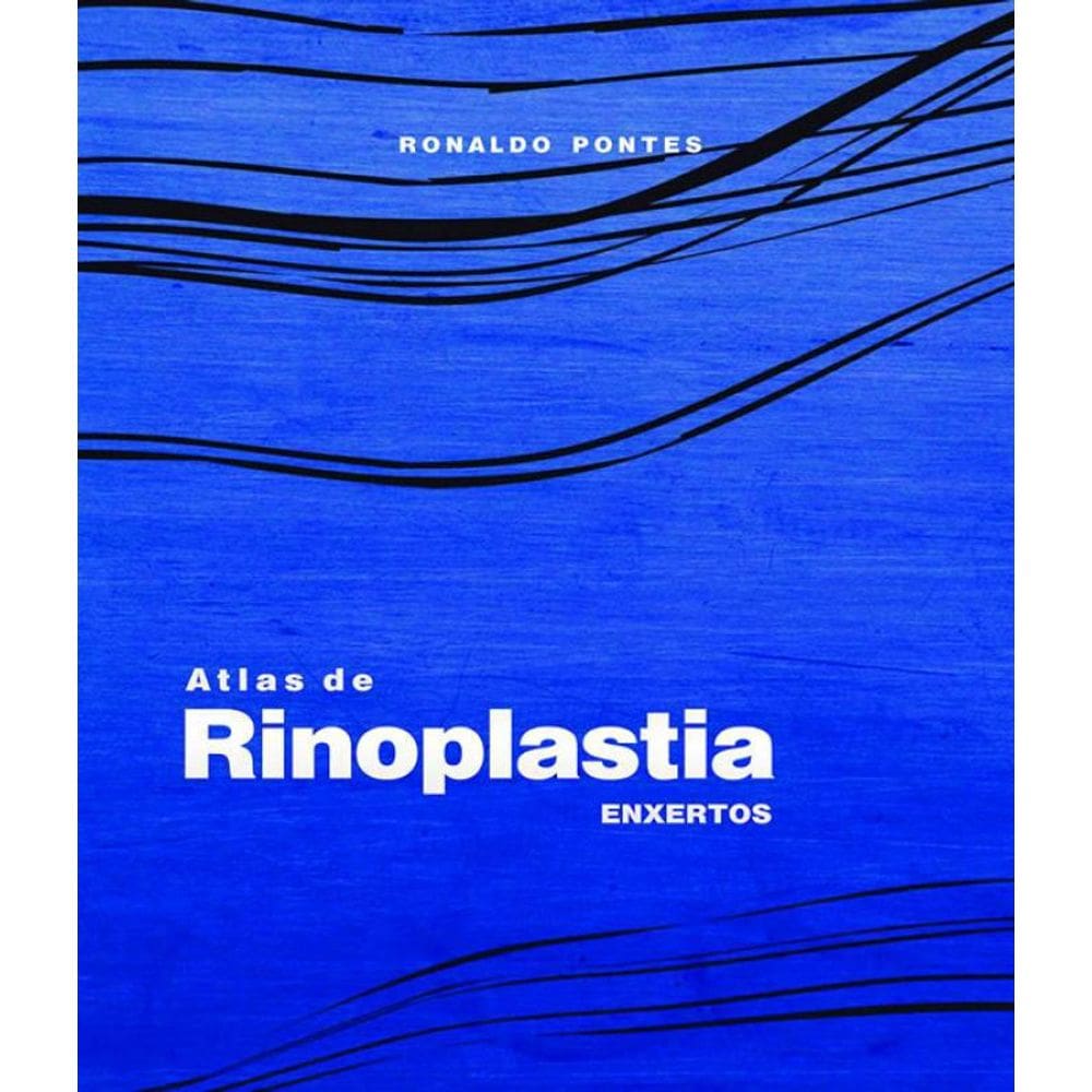 Livro Atlas De Rinoplastia: Enxertos
