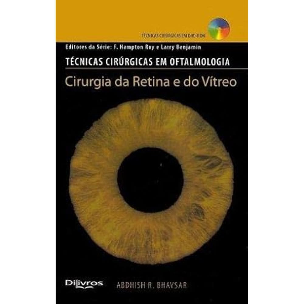 Técnicas cirúrgicas em oftalmologia, Cirurgia da Retina e do Vítreo