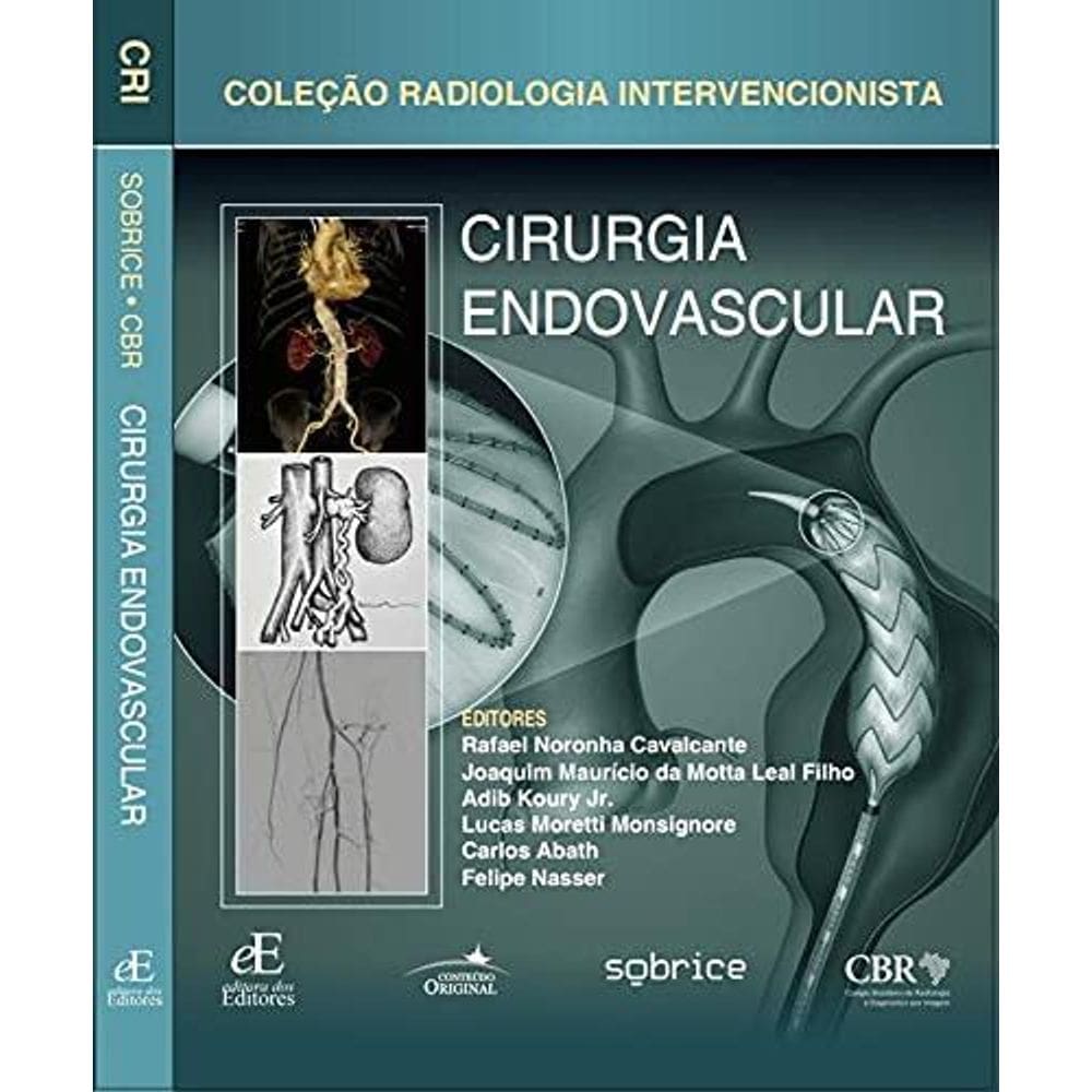 Cirurgia Endovascular