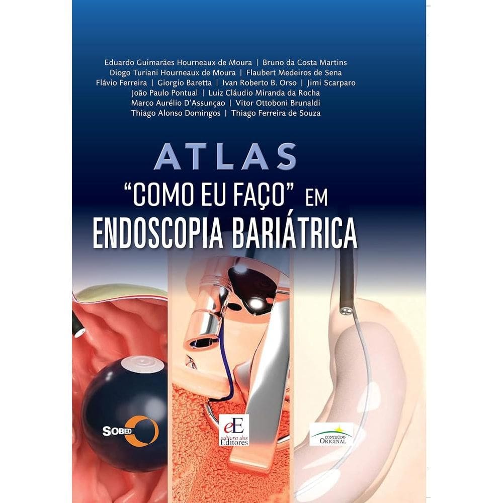 Atlas Como Eu Faco Endoscopia Bariatrica