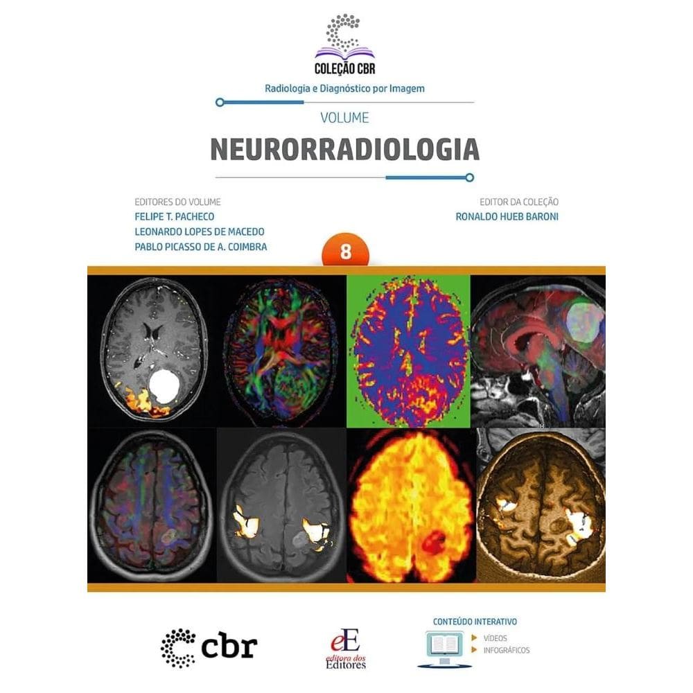 Coleção CBR Volume 8 NEURORRADIOLOGIA