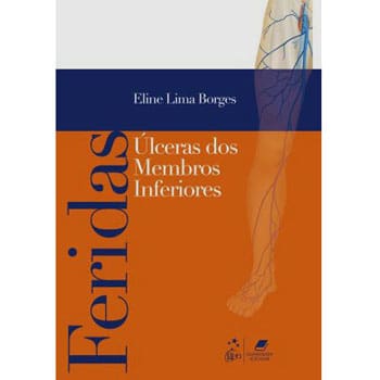 imagem-Livro - Feridas: Úlceras de Membros Inferiores - Eline Lima Borges
